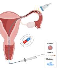 Robotic magnetic microcatheter that traverses the cervix into the vagina and fallopian tubes, actively propelling and pushing the medical tube forward, through which gametes, embryos, or medications are locally released.